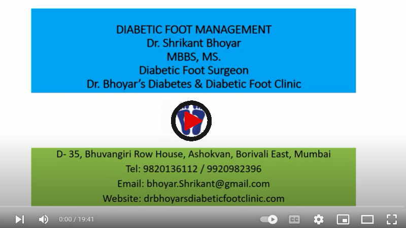 Diabetic Foot Management by Dr Shrikant Bhoyar , Diabetic Foot Surgeon 55 cases