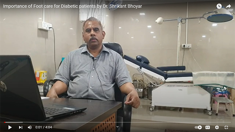 Diabetic Foot Management by Dr Shrikant Bhoyar , Diabetic Foot Surgeon 55 cases