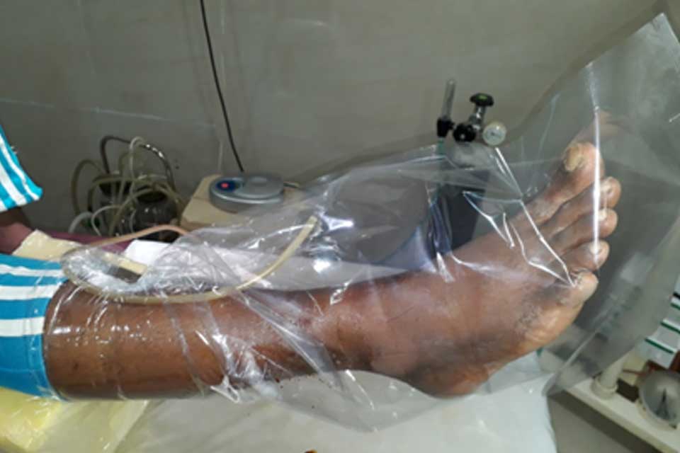 Ozone Therapy